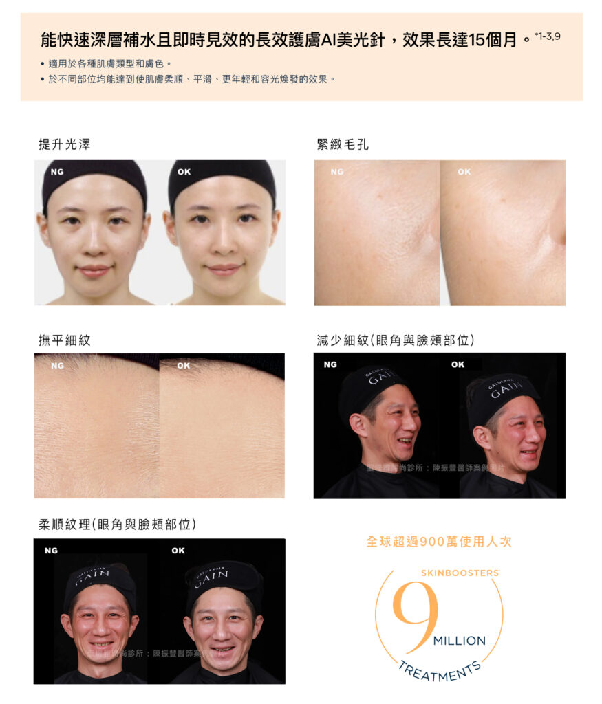 瑞絲朗 Skinboosters AI 美光針可以維持多久?